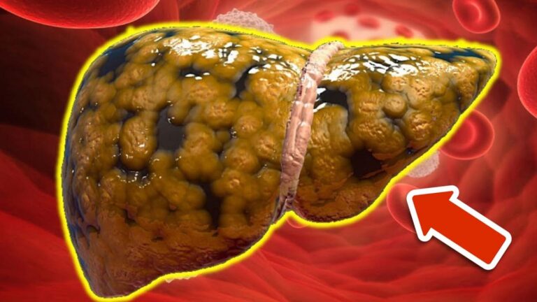 6 superfoods, które oczyści twoją wątrobę i poprawią samopoczucie!